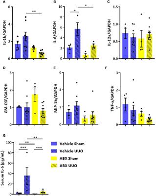 Gut Microbiota and Intestinal Epithelial Myd88 Signaling Are Crucial for Renal Injury in UUO Mice